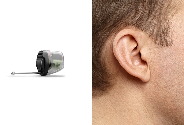 IIC invisible hearing aids Sydney Campbelltown IIC invisible hearing aids Sydney Campbelltown