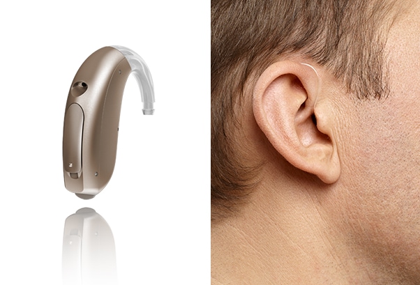 miniBTE Hearing Aids Sydney miniBTE Hearing Aids Sydney